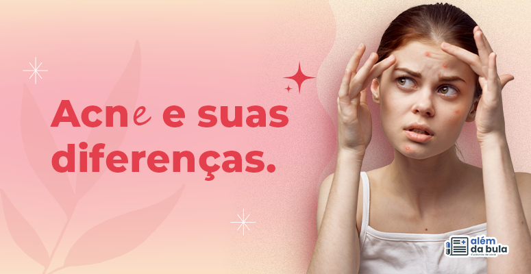 Imagem que traz uma mulher ruiva, com as mãos abertas ao redor do rosto, mostrando algumas espinhas. Ela demonstra preocupação pela acne, a imagem traz a seguinte frase: “Acne e suas diferenças”. 