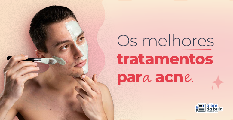 Imagem de um homem branco com acne, ele está com as mãos levantadas até a altura do rosto, e está aplicando uma máscara facial na pele, com ajuda de um pincel. Na imagem consta a seguinte frase: “Os melhores tratamentos para acne”.